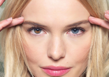 Celebrities with Heterochromia Iridum