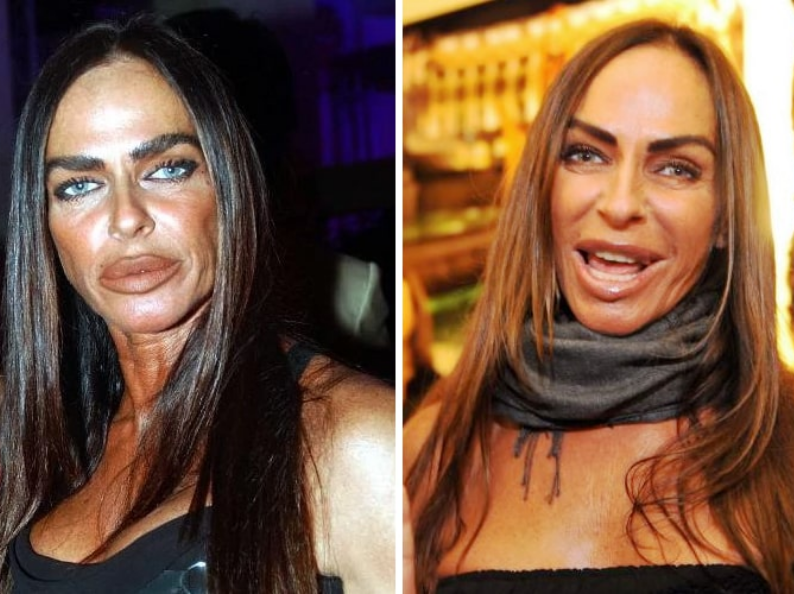Once A Beautiful Italian Face Turned Out To Be A Freakish Fright