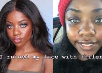 “I Ruined My Face”, Pretty Privilege, Insecurities