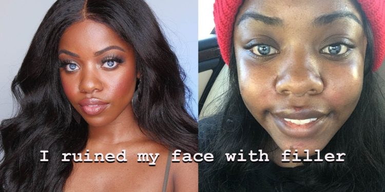 “I Ruined My Face”, Pretty Privilege, Insecurities