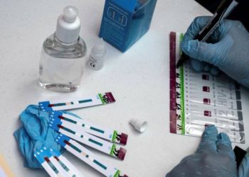 New HIV Variant Discovered: Maybe More Infectious and Severe