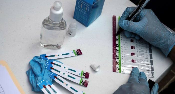 New HIV Variant Discovered: Maybe More Infectious and Severe